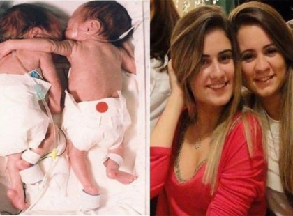 A megmentő ölelés nevű fénykép 1995 ben készült.....