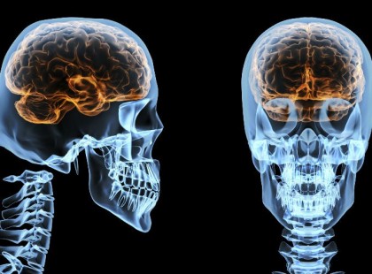 Az agyvérzéses stroke felismerése