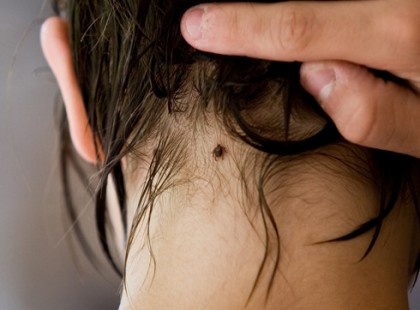 Tények a kullancsokról, amiről rosszul tudunk