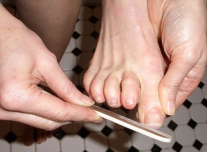 Két természetes gyógymód a körömgomba ellen