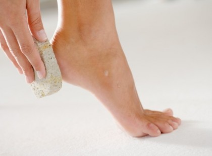 Egy működő recept a repedezett sarkakra