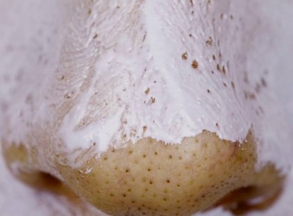 Hogyan szabaduljunk meg a mitesszerektől 30 perc alatt természetesen?