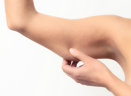 Így tüntetsd el a löttyedt kart!