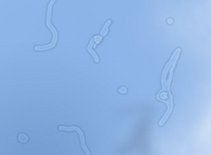 Ezért látunk úszkáló foltokat a szemünk előtt