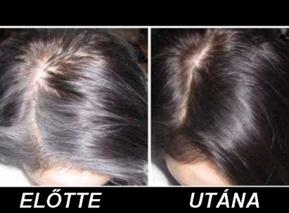 Íme egy természetes recept, amitől az ősz hajszál a múlté