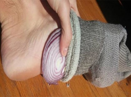 EZ TÖRTÉNIK, HA MINDENNAP EGY SZELET HAGYMÁVAL A ZOKNIDBAN ALSZOL