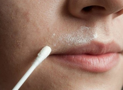 Ha zavar a bajuszka, orrod alatti szőr készítsd el ezt a természetes receptet, amivel örökre megszabadulhatsz a szőrpihéktől