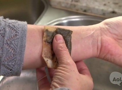 Vett egy teafiltert és a kezére tette… Meg fogsz lepődni, hogy miért!