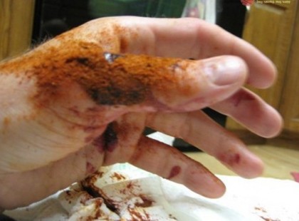 10 másodperc alatt megállítható a vérzés ezzel a módszerrel