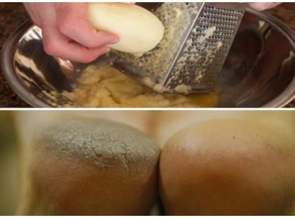 Ezért tegyél krumplit a zoknidba éjszakára!