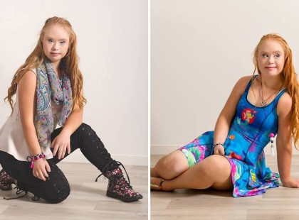 Madeline Stuart, egy down-szindrómában szenvedő kislány álma mindig is az volt, hogy modell legyen. Most megadatott neki ez a lehetőség, ugyanis egy ruhavállalat leszerződött vele.