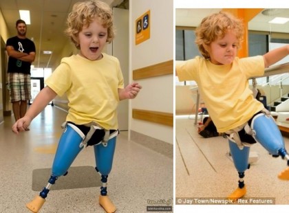 Ezt a fotót azoknak ajánlom,akik aránylag jó módban élnek,de nyavalyognak,hogy ez sincs,az sincs. Itt ez a gyerek,nincs lába,így indul az életnek,de nézd meg az arcát,milyen boldog ,hogy menni tud.