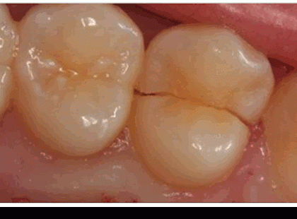 6 életmentő jel, amit a tested küld Neked. Így értelmezd a jeleket