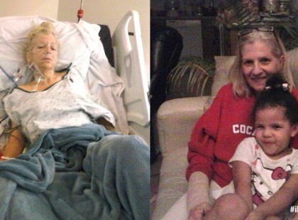 Végstádiumú rákos beteg volt, és egyetlen olaj kiűzte szó szerint a rákot a testéből