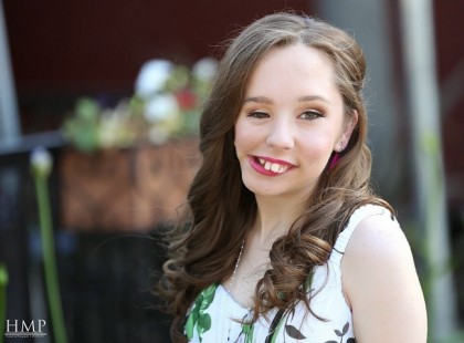 Társai mindennap piszkálták külseje miatt, aztán egy nap leesett az álluk