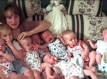 18 évesek a világ első túlélő hetes ikrei, így néznek ki felnőtten!