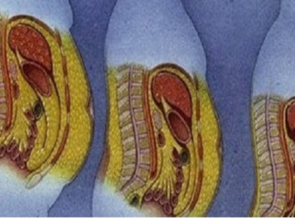 Hasi zsírgyilkos szuper reggeli! Csak a súlyodat veszítheted
