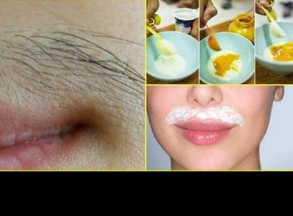 Ezzel a házi keverékkel távolíthatod el a női arcszőrzetet végleg