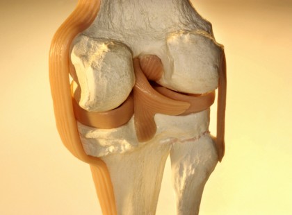 ITT A FILLÉRES GYÓGYMÓD, AMI GARANTÁLTA JAVÍTJA ÍZÜLETEINK EGÉSZSÉGÉT!