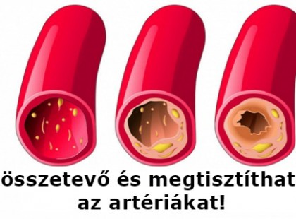 Tisztítsuk meg a szív koszorúereit ezzel a 3 természetes hozzávalóval!