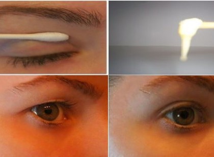 Két perc alatt szabadulj meg a megereszkedett szemhéjaktól ezzel a varázsrecepttel