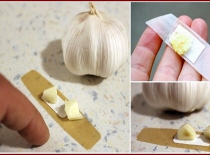 Kis darab fokhagymát ragasztott a bőrére sebtapasszal! Az eredménytől te is el leszel kápráztatva!