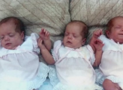 EZEK A BABÁK TÖBB MINT 20 ÉVE SÚLYOSAN MEGÉGTEK, NÉZD, MI LETT BELŐLÜK!