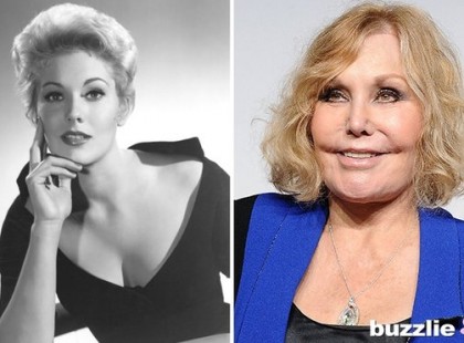 Ezekre a plasztikai műtétekre nincs magyarázat