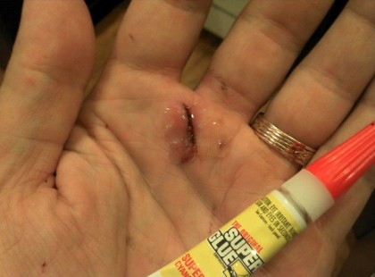 Ápolónők titkos trükkjei, most neked is elárulom őket!