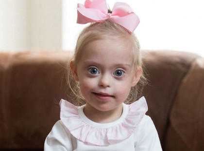 Modellszerződést kapott egy Down-szindrómás kislány a gyönyörű mosolya miatt <3