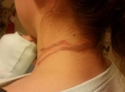 Telefonálás közben hibázott a lány.. Majdnem az élete bánta!