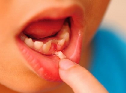 Nehogy eldobd a gyermek tejfogát! Megmentheted vele az életét!