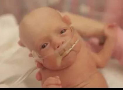 3 és fél hónaposan jött világra ez a kisfiú! Nézd meg, miként reagál édesanyja, mikor először veszi karjaiba!