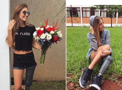 Ezeket a fotókat azoknak ajánlom,akik aránylag jó módban élnek,de nyavalyognak,hogy ez sincs,az sincs. Itt ez a vidám lány,két éve amputálták a lábát ,de nézd meg az arcát,milyen boldog ,hogy menni ,sportolni,úszni tud.