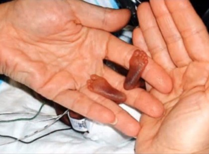 Az orvos sem hitte, hogy ez a baba világra jön... pedig nem is tudott, az édesanya hazugságáról!