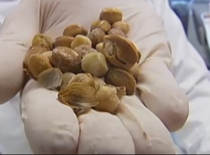 Ez a gyümölcs pár perc alatt megöli a rákot!