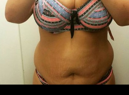 Az eladó beszólt, hogy ilyen kövérek nem szoktak bikinit venni. Nézd, mi lett belőle!