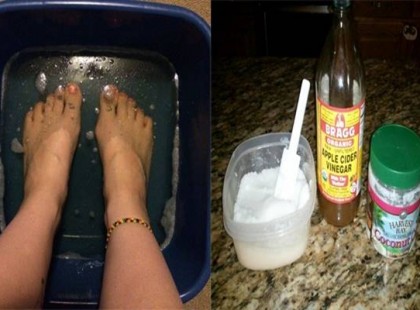 Így használd az almaecetet, ami örökre száműzi az izom- és ízületi fájdalmakat, gyulladásokat!