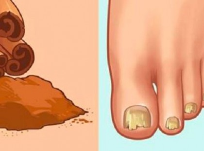 A fahéj 8 szokatlan felhasználási módja, amelyről eddig soha nem hallottál!