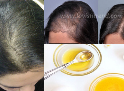 Mágikus recept, ettől olyan gyorsan fog nőni a hajad, hogy mindenki azt hiszi, hozzávarrattál!