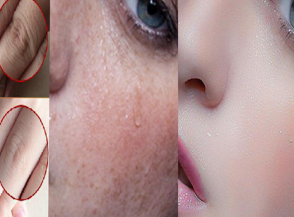 Kend az arcodra lefekvés előtt ezt a kencét, reggelre igazi csoda történik majd az arcoddal!