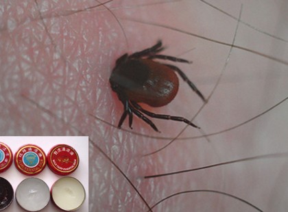 Kullancs elleni védekezés, ahogyan az Orosz katonák csinálják....