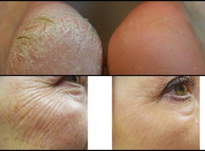 Kisimítja a ráncaid, felpuhítja a sarkat és a talpat és mindig van otthon!