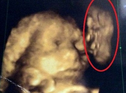 A várandós kismama olyat látott az ultrahangon, amitől szólni sem nagyon tudott!