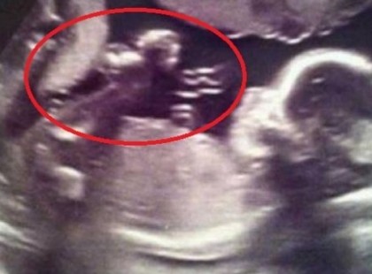 Mikor ránéztek az ultrahangfelvételre, beledermedtek abba, amit láttak!