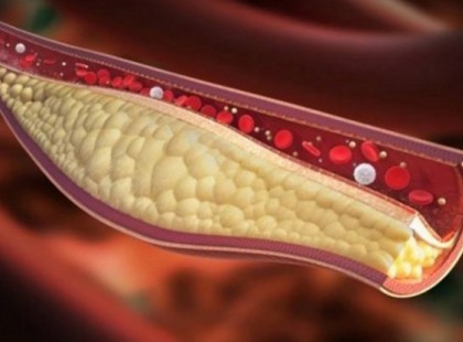 Elég egy pohárnyi ebből az italból, hogy az egész érrendszerünk megtisztuljon!