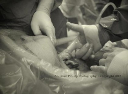 Császármetszés közben az orvos ordítva hívta a férjet. Az azonnal kamerázni kezdett !