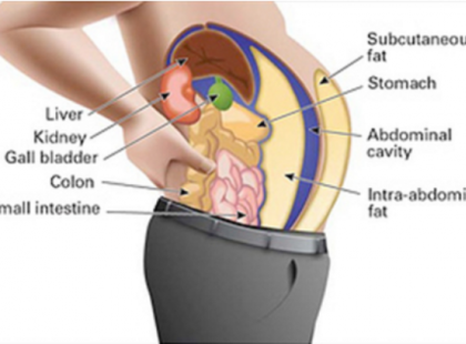 A zsírsejtekben tárolt méreganyagok tesznek kövérré és puffadtá – Így szabadulhatsz meg tőlük!