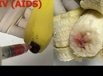 Figyelem : HIV vírussal fertőzött banánokat találtak