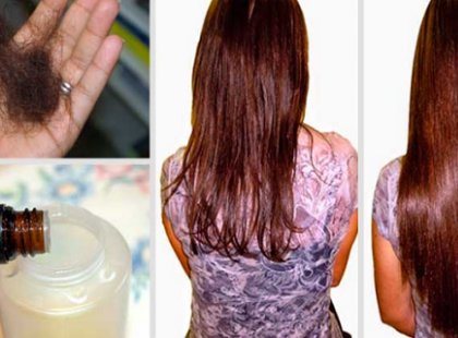 Tedd ezt a két hozzávalót a samponodba és mondj örökre búcsút a hajhullásnak!